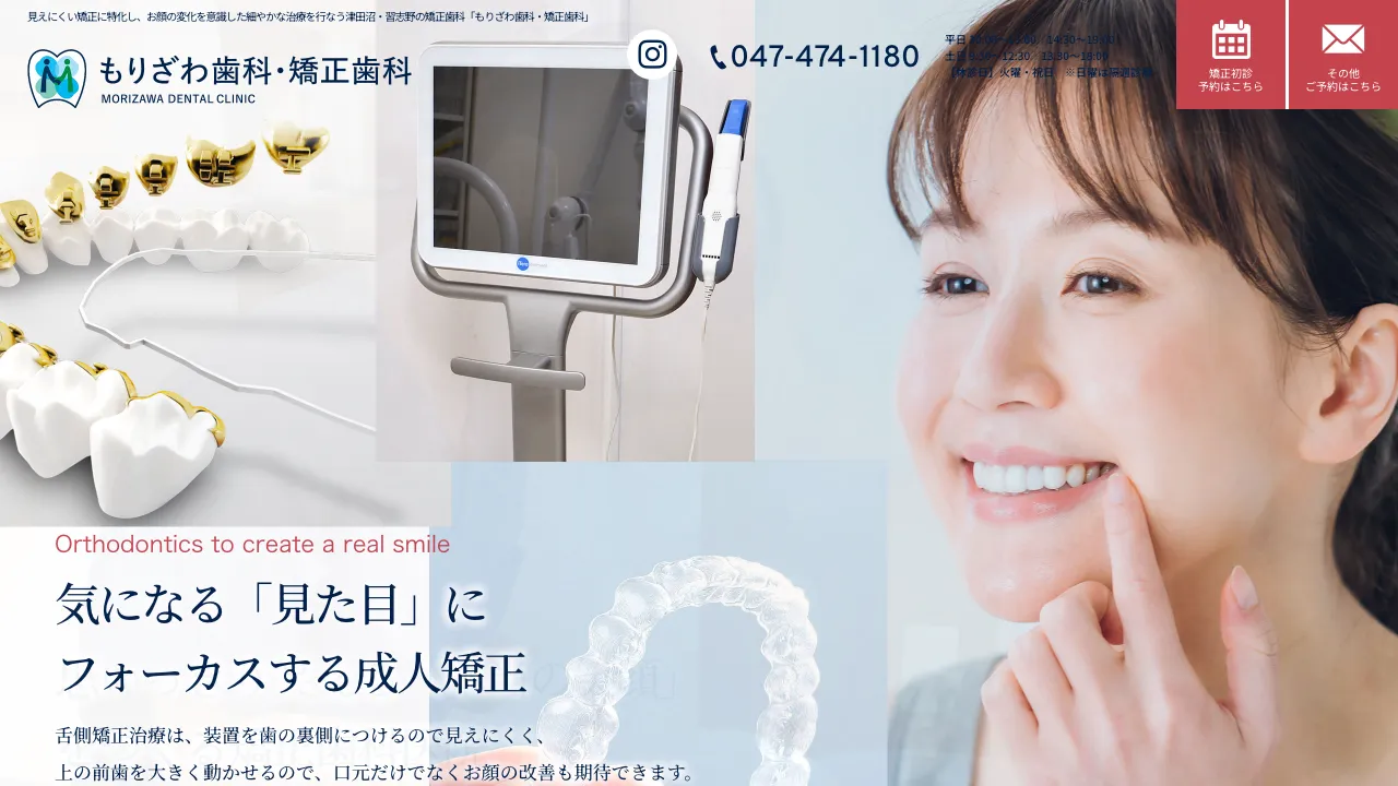 もりざわ歯科・矯正歯科のホームページ