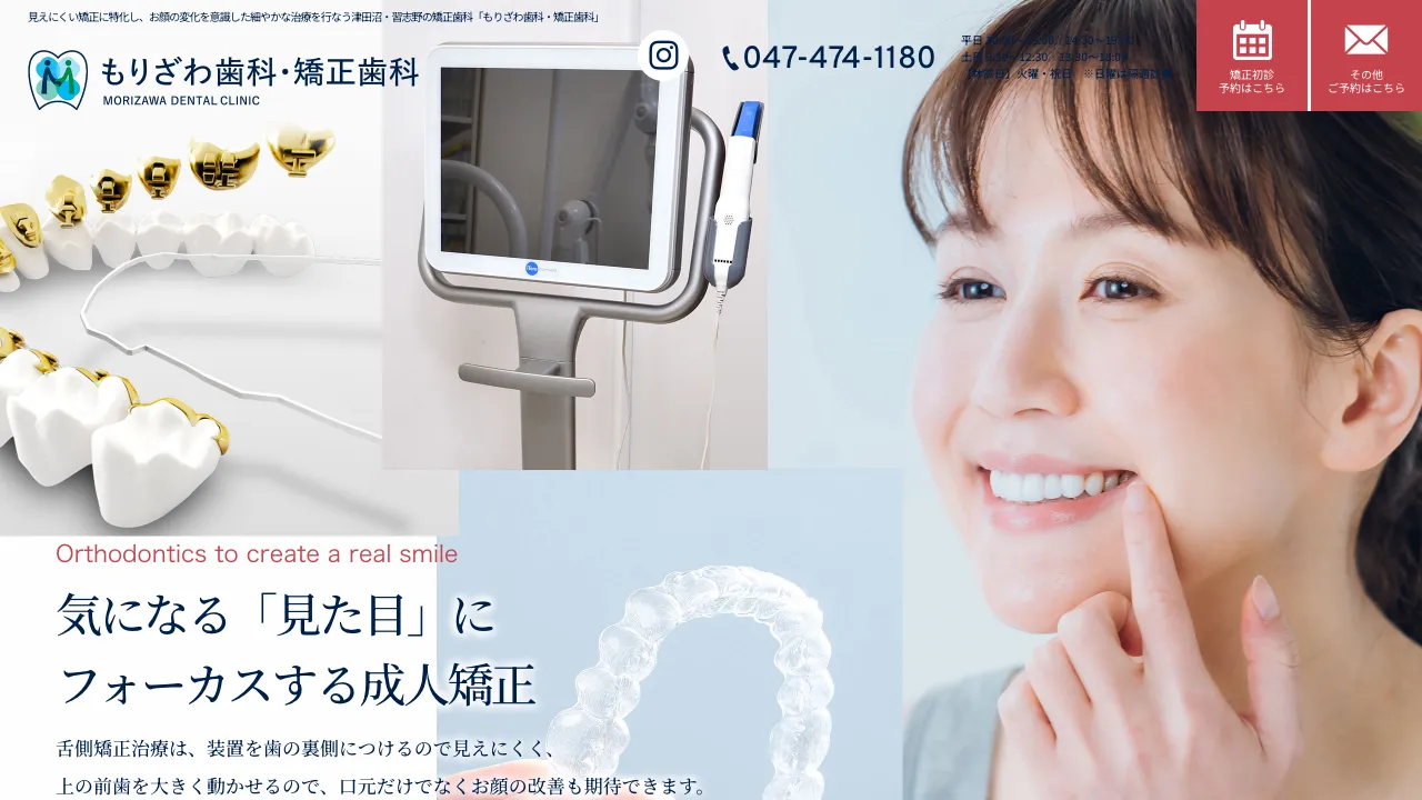 もりざわ歯科・矯正歯科のホームページ